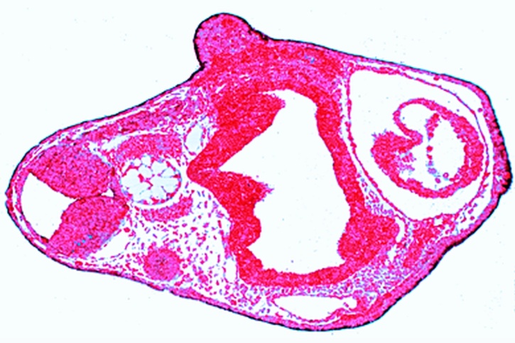 Mikropräparat - Frosch, Älteres Schwanzknospenstadium, Querschnitt durch die Körperregion. Neuralrohr, Chorda, Mesoderm-Differenzierung