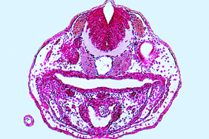 Mikropräparat - Frosch, Ältere Kaulquappe, Querschnitt durch die Herz-Lungenregion