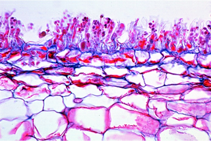 Mikropräparat - Taphrina (Exoascus) pruni, Narrentaschen der Zwetschgen, Wirtsgewebe mit Asci, quer