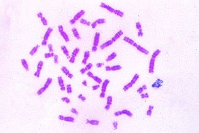 Mikropräparat - Chromosomen des Menschen aus Leukozytenkultur, männlich