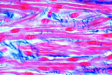 Mikropräparat - Glatte Muskeln des Menschen, quer und längs