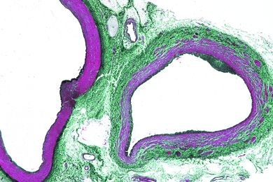 Mikropräparat - Arterie und Vene des Menschen, quer, Elastica-Färbung