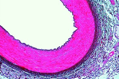 Mikropräparat - Aorta des Menschen, quer, Färbung der elastischen Fasern