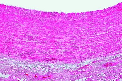Mikropräparat - Aorta des Menschen, quer. Übersichtsfärbung