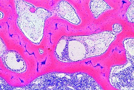 Mikropräparat - Rotes Knochenmark, embryonaler Röhrenknochen vom Mensch, quer