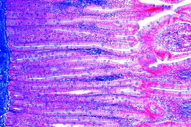 Mikropräparat - Dünndarm (Duodenum), Färbung der Schleimzellen mit PAS-HE