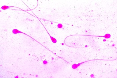 Mikropräparat - Spermatozoen, Ausstrich