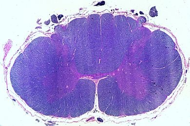 Mikropräparat - Rückenmark, Cervicalregion quer, Klüver-Barrera