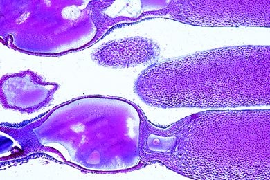Mikropräparat - Insektenovarium mit telotrophen Ovariolen, längs