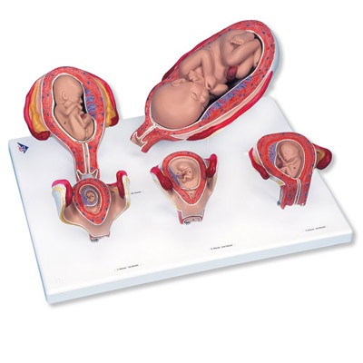 Schwangerschafts - Serie, 5 Modelle