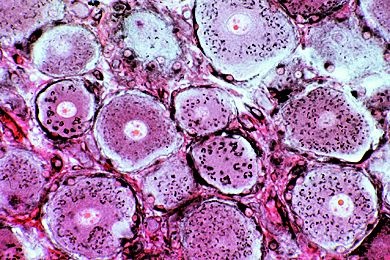 Mikropräparat - Golgi-Apparat in Zellen des Spinalganglions *