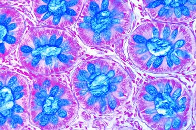 Mikropräparat - Schleimdrüsen im Darmepithel, Mensch, Färbung der Becherzellen (PAS-HE)