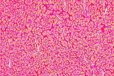 Mikropräparat - Elastisches Bindegewebe, Ligamentum nuchae vom Rind, quer. Färbung mit Pikrofuchsin