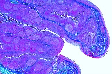 Mikropräparat - Tonsilla palatina (Gaumenmandel) vom Menschen, quer
