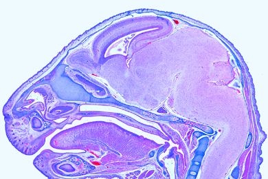Mikropräparat - Embryo der Maus, Kopf quer