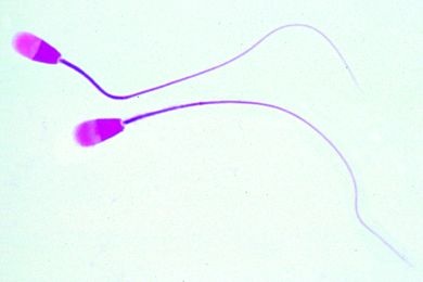 Mikropräparat - Spermatozoen vom Rind, Ausstrich