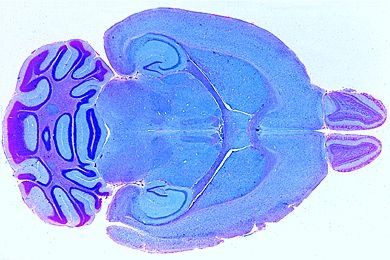 Mikropräparat - Gehirn der Maus, ganzes Organ, Frontalschnitt