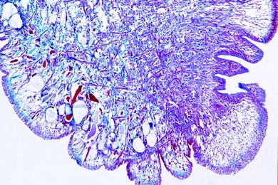 Mikropräparat - Helix pomatia, Weinbergschnecke, Fuß sagittal längs