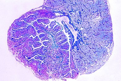 Mikropräparat - Helix pomatia, Spermoviduct quer