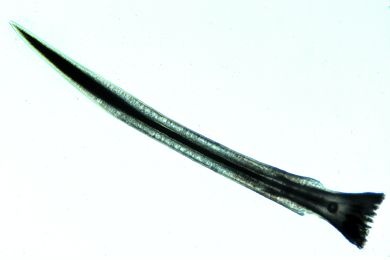 Mikropräparat - Helix pomatia, Penis quer