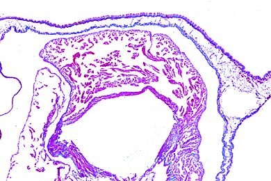 Mikropräparat - Helix pomatia, Sommerniere und Herz, quer
