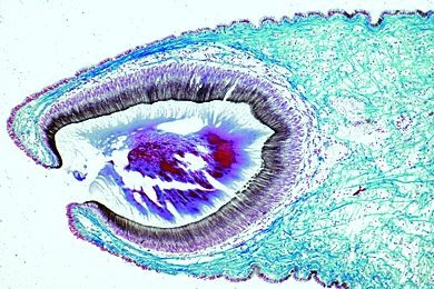 Mikropräparat - Haliotis spec., Seeohr, Schnitt durch das Lochkamera-Auge