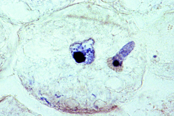 Mikropräparat - Ascaris megalocephala Embryologie. Uterus quer