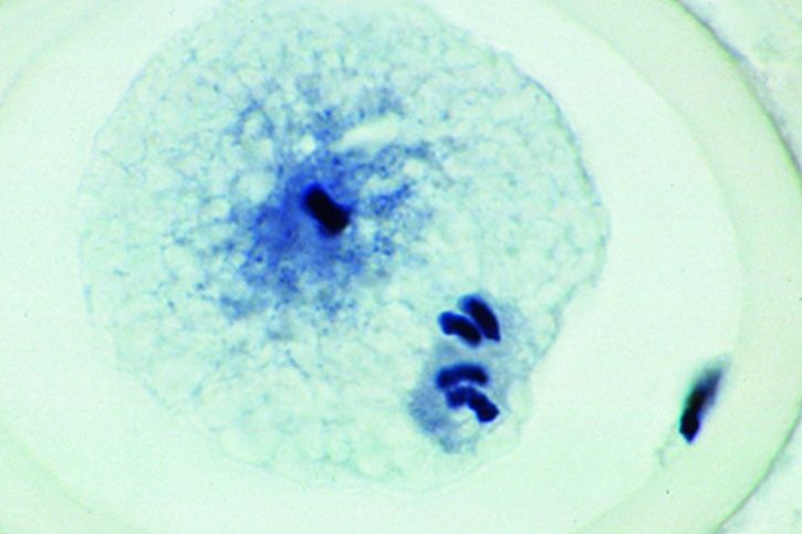 Mikropräparat - Ascaris megalocephala Embryologie. Uterus quer: Erste ...