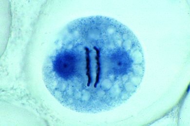 Mikropräparat - Ascaris megalocephala Embryologie. Uterus quer: Frühe ...