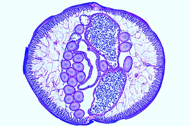 Mikropräparat - Ascaris lumbricoides, Spulwurm vom Menschen, Weibchen