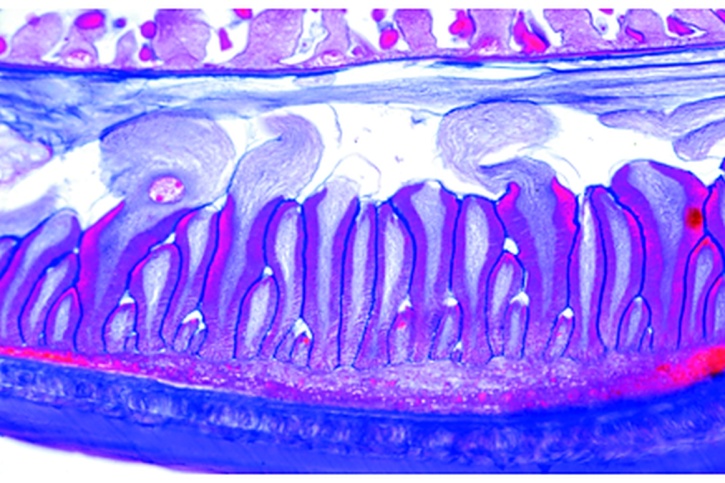 Mikropräparat - Ascaris lumbricoides, isolierte Muskelzellen