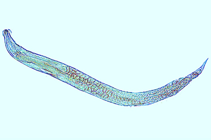 Mikropräparat - Enterobius vermicularis (Oxyuris), Madenwurm, Männchen oder Weibchen total