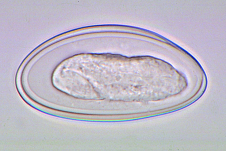 Mikropräparat - Enterobius vermicularis, Eier im Stuhl