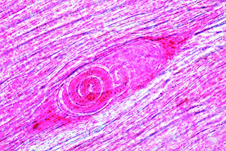 Mikropräparat - Trichinella spiralis, Larven im Muskel, Quetschpräparat