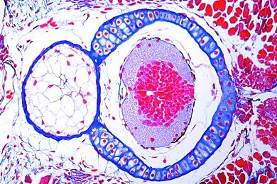 Mikropräparat - Scyllium, Wirbel mit Rückenmark und Chorda, quer