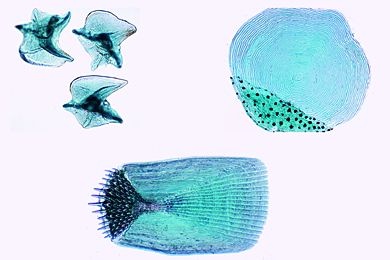 Mikropräparat - Fischschuppen-Typen. Cycloid-, Placoid-und Ctenoidschuppen