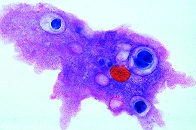 Mikropräparat - Amoeba proteus, Amöben, Zellkern, Ekto- und Endoplasma, Nahrungsvakuolen, Pseudopodien