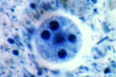 Mikropräparat - Entamoeba histolytica, Ausstrich mit 1 - 4 kernigen Zysten, Spezialfärbung