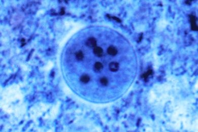 Mikropräparat - Entamoeba coli, Ausstrich mit 2 - 8 kernigen Zysten, Spezialfärbung *
