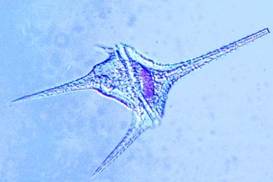 Mikropräparat - Ceratium hirundinella, Panzergeißler (Dinoflagellaten)