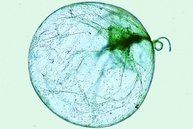 Mikropräparat - Noctiluca miliaris, Verursacher des Meerleuchtens