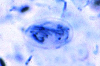 Mikropräparat - Giardia lamblia intestinalis, Ausstrich mit Zysten *