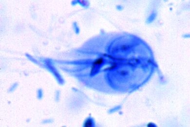 Mikropräparat - Giardia lamblia intestinalis, Darmparasit, *