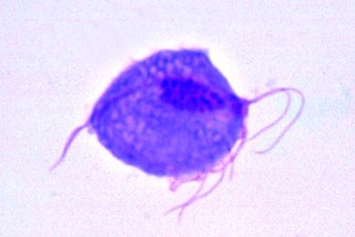 Mikropräparat - Trichomonas vaginalis, Ausstrich