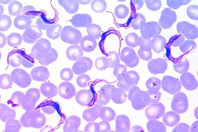 Mikropräparat - Trypanosoma gambiense, Erreger der Schlafkrankheit des Menschen. Blutausstrich gefärbt nach Giemsa
