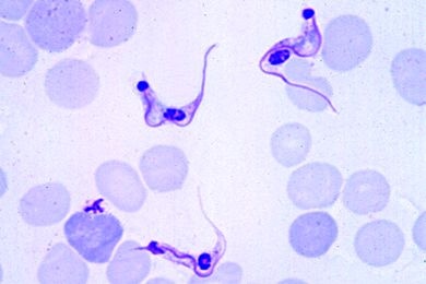Mikropräparat - Trypanosoma cruzi (Schizotrypanum), Erreger der Chagaskrankheit des Menschen. Blutausstrich mit Trypanosomen Mikropräparat - Trypanosoma cruzi (Schizotrypanum), Erreger der Chagaskrankheit des Menschen. Blutausstrich mit Trypanosomen