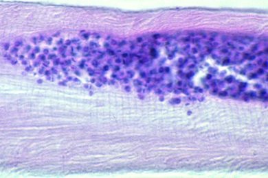 Mikropräparat - Trypanosoma cruzi, Schnitt durch den erkrankten Herzmuskel mit Leishmania-Formen *
