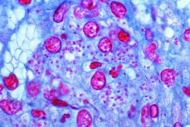 Mikropräparat - Leishmania donovani, Schnitt durch die infizierte Milz oder Leber. Intrazelluläre Lage der Parasiten