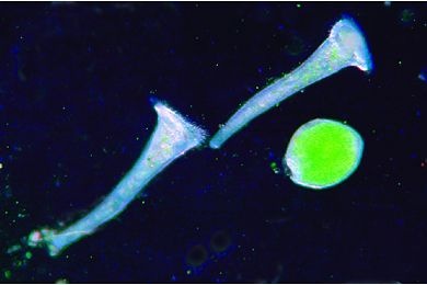 Mikropräparat - Stentor, Trompetentierchen, heterotriches Infusor *