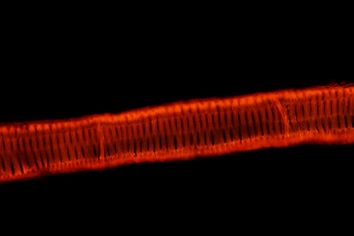 Mikropräparat - Pteridium, Rhizom längs. Treppengefäße im Schnitt